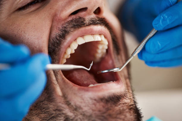 Best Weekend Emergency Dentist in Seat Pleasant, MD